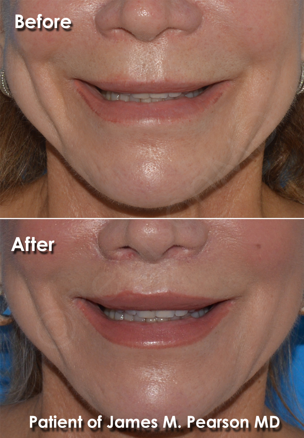 Dr. Pearson Plastic Surgery