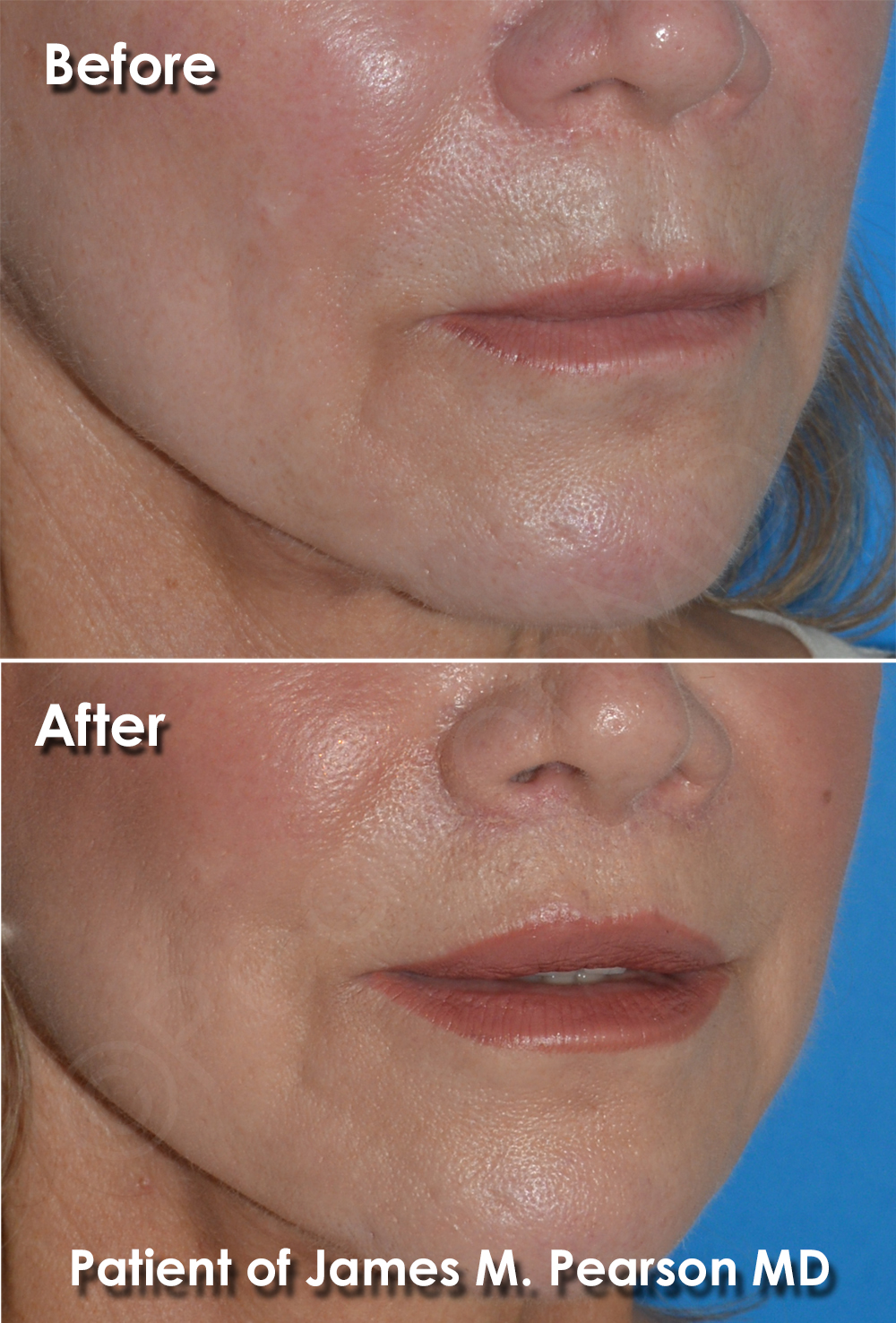Manhattan Beach Plastic Surgery