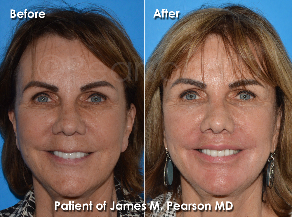 Dr. Pearson Plastic Surgery