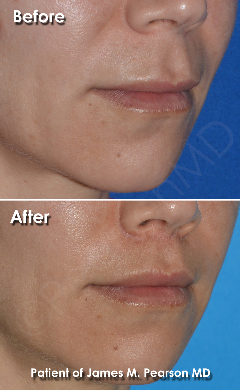 Dr. Pearson Plastic Surgery