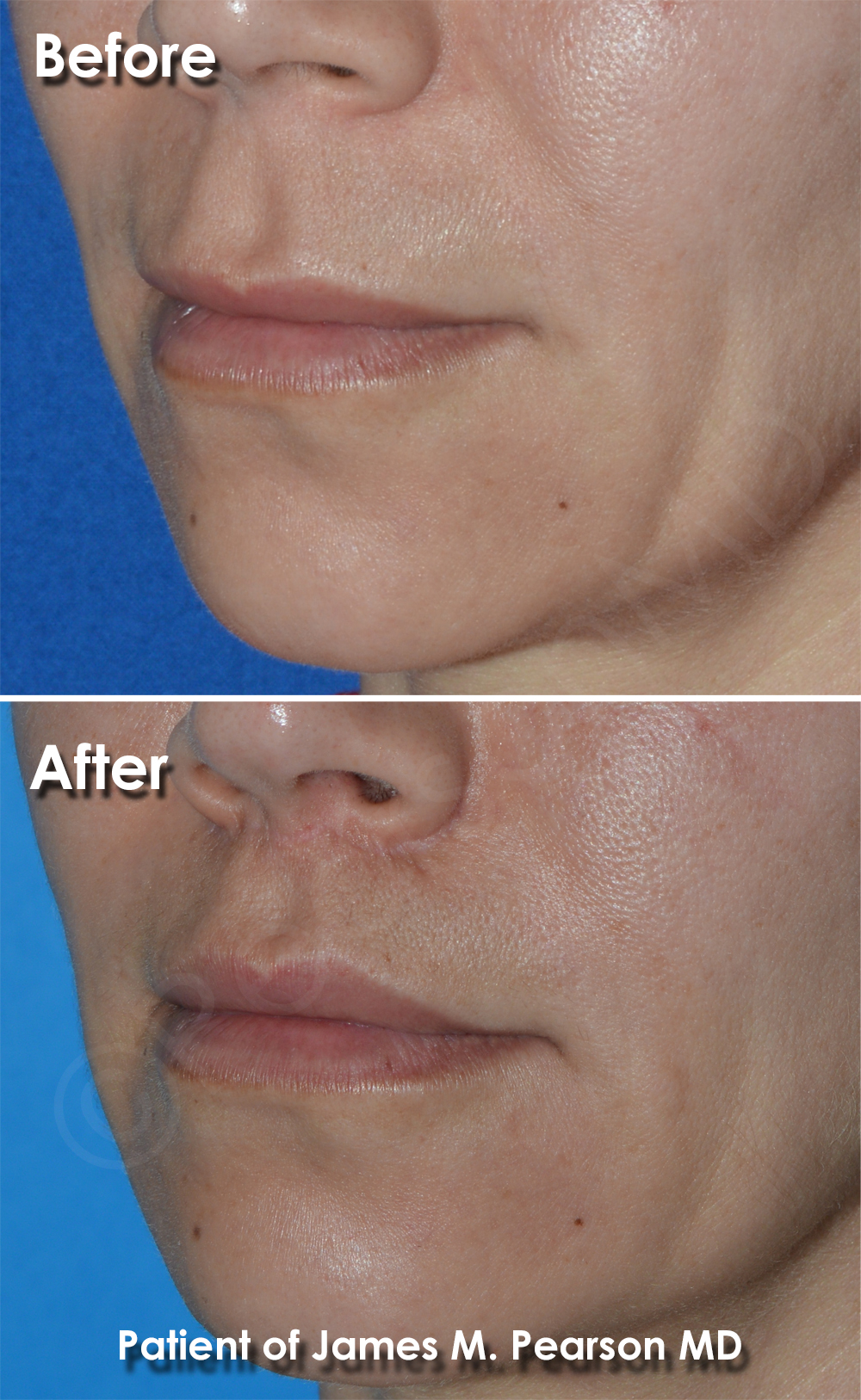Pearson Cosmetic Surgery