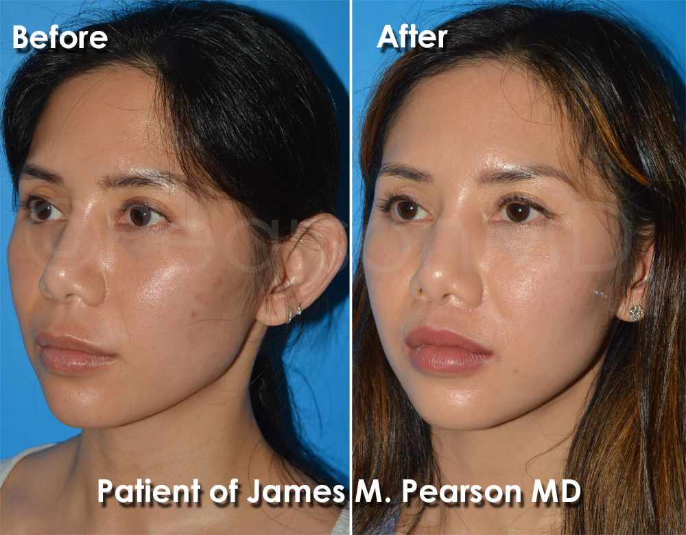 Pearson Plastic Surgery