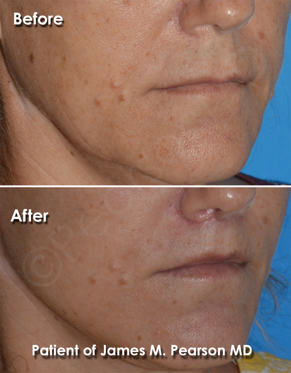 Pearson Cosmetic Surgery