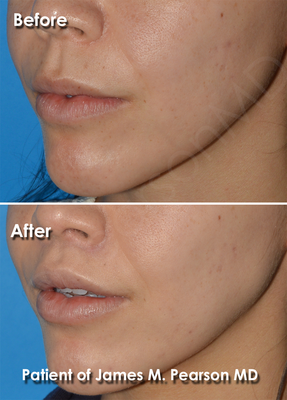 Pearson Cosmetic Surgery