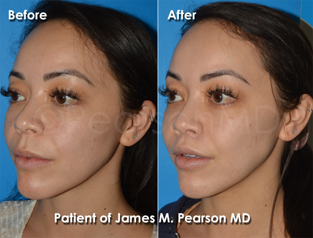 Pearson Cosmetic Surgery