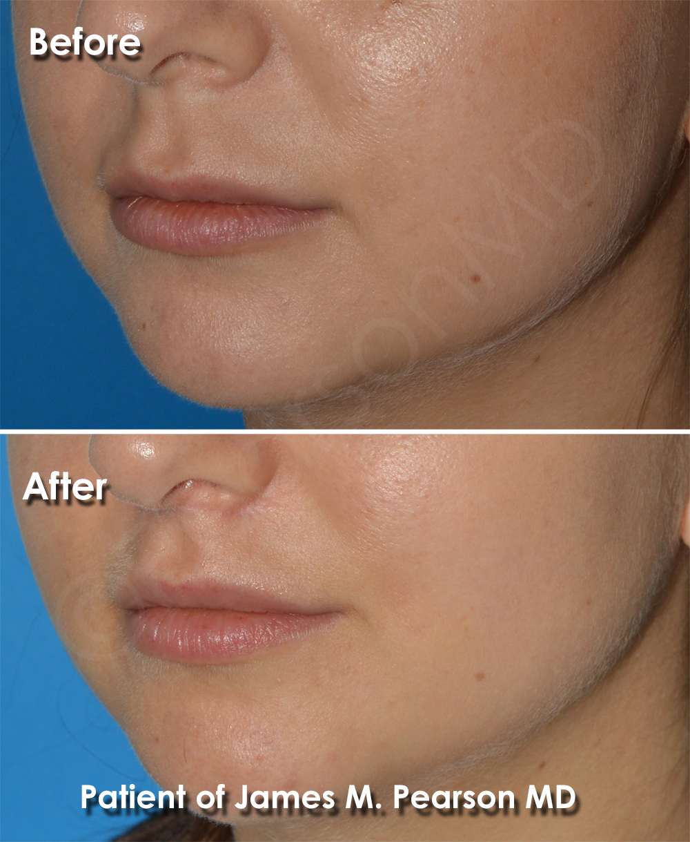 Pearson Cosmetic Surgery