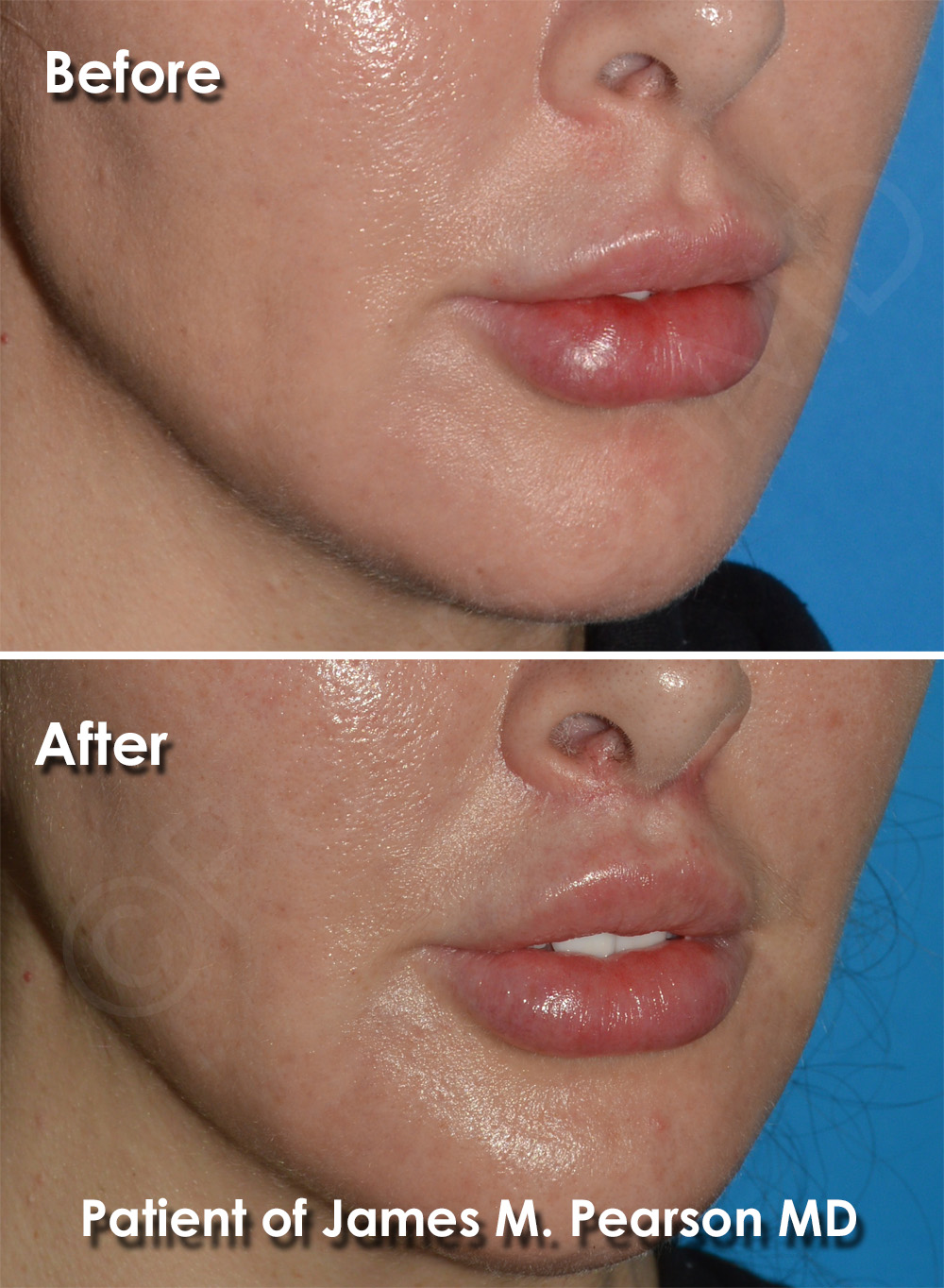 Pearson Plastic Surgery