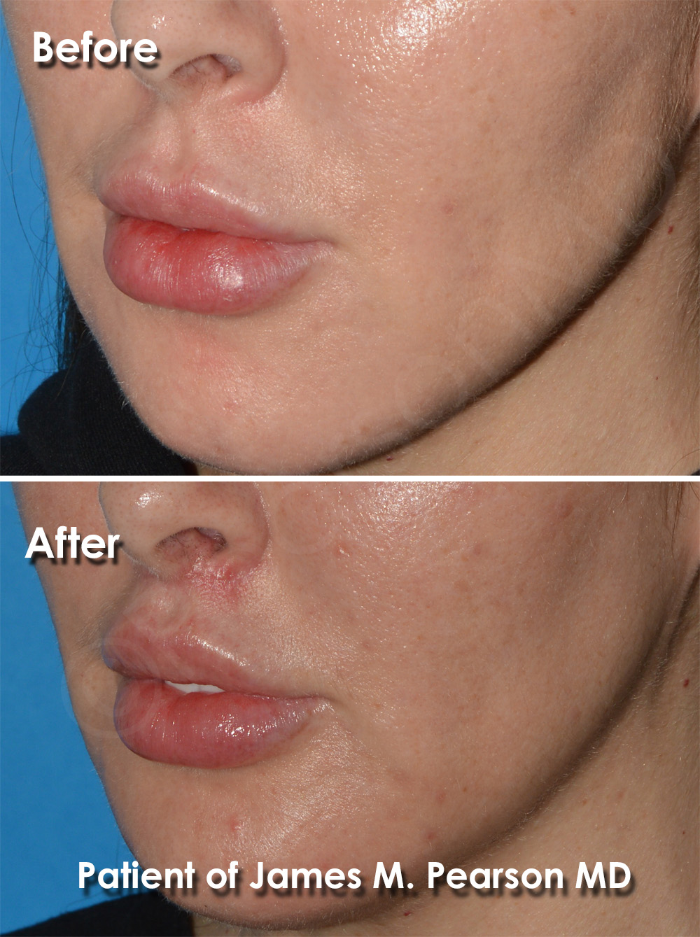 Pearson Cosmetic Surgery