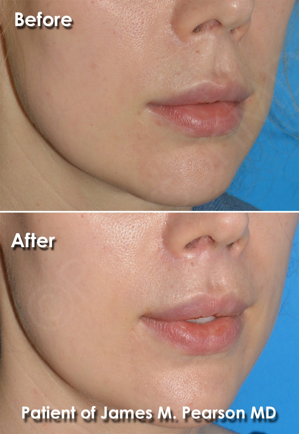 Pearson Cosmetic Surgery