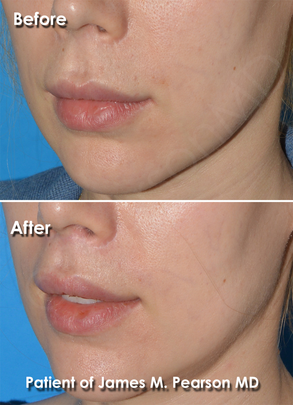 Dr. Pearson Cosmetic Surgery