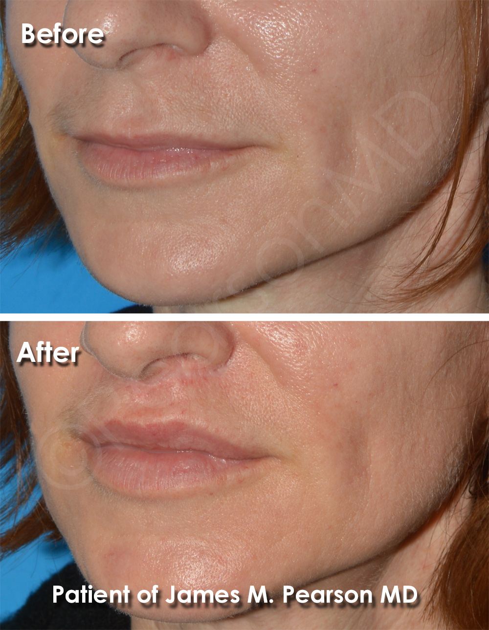 Pearson Cosmetic Surgery