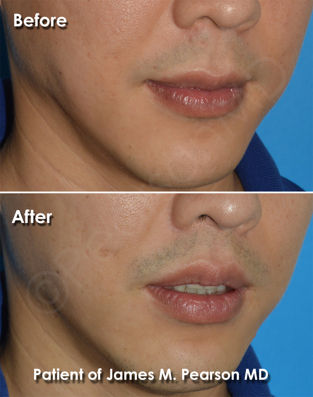 Pearson Cosmetic Surgery