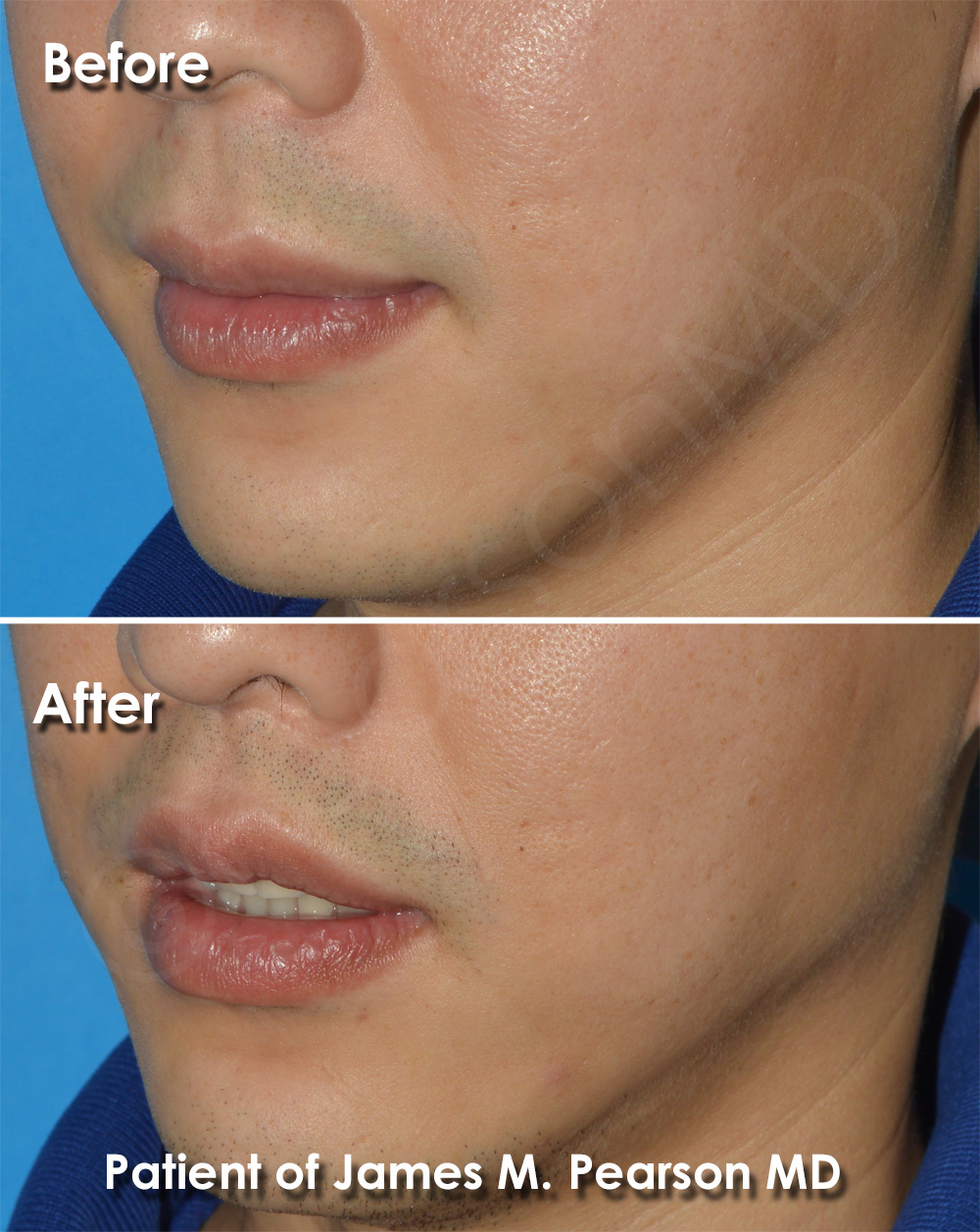 Pearson Plastic Surgery
