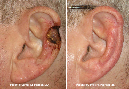 Photo Pearson Reconstructive Surgery
