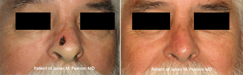 Photo Pearson Reconstructive Surgery