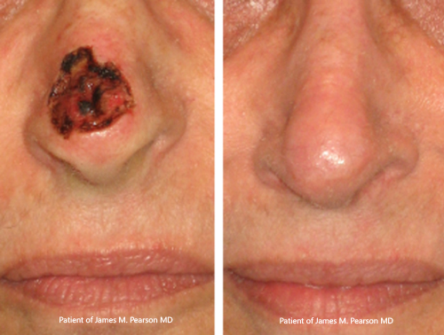 Photo Pearson Reconstructive Surgery