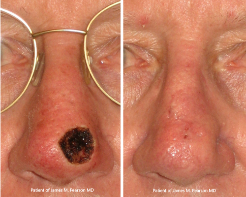 Photo Pearson Reconstructive Surgery