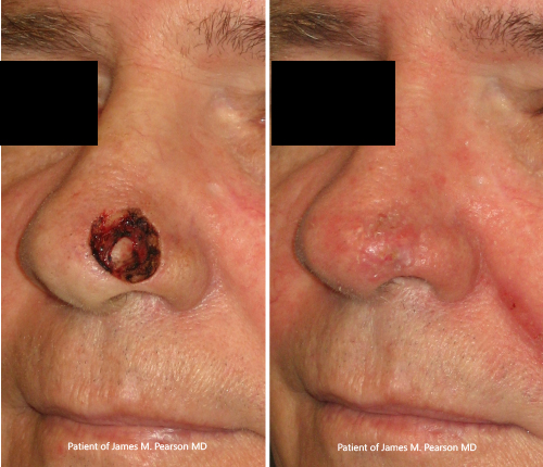 Photo Pearson Reconstructive Surgery