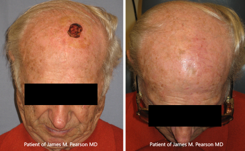 Photo Pearson Reconstructive Surgery